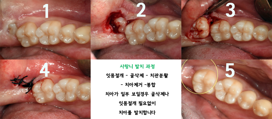 제목 없음1-1